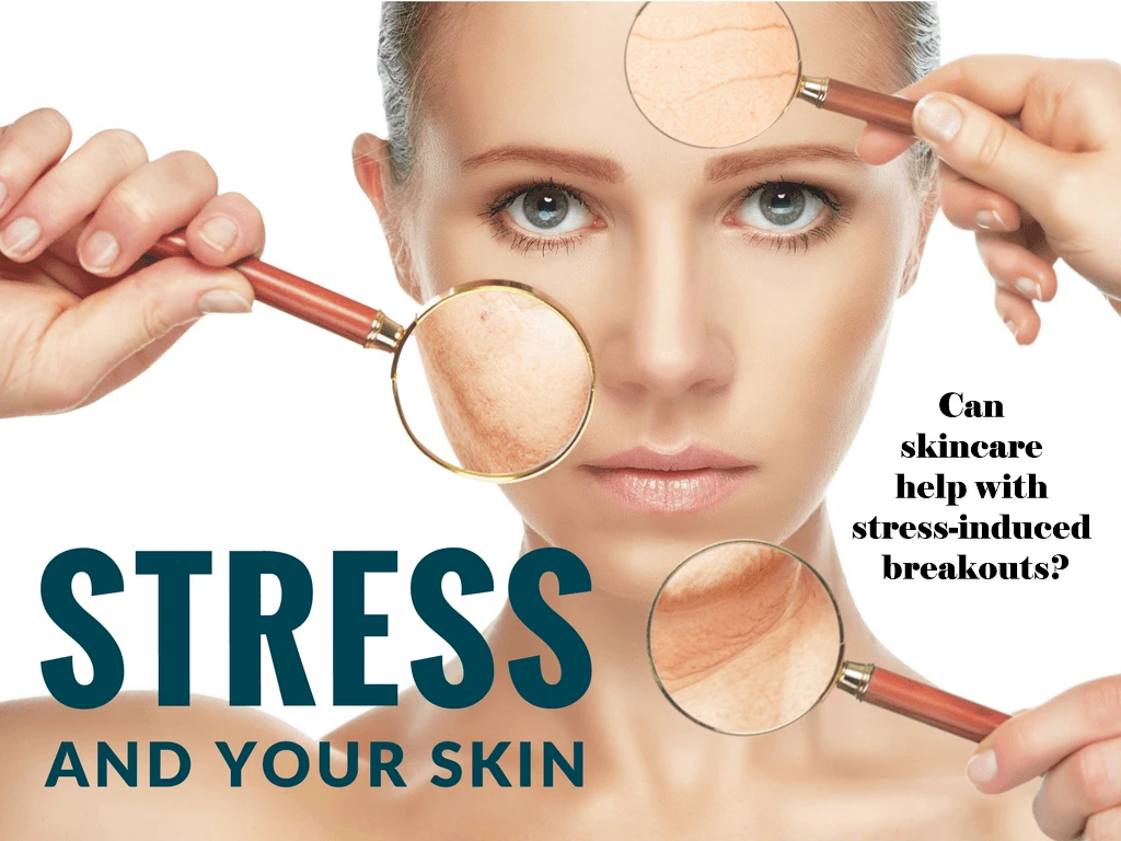 Can skincare help with stress-induced breakouts?