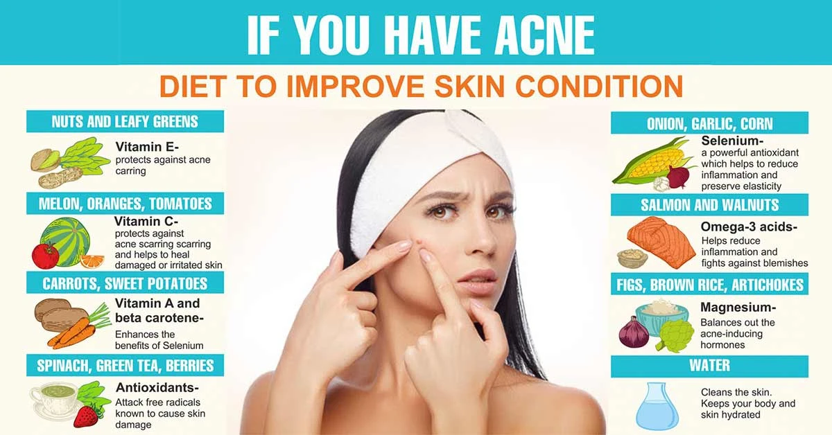 Common foods to avoid if you have acne