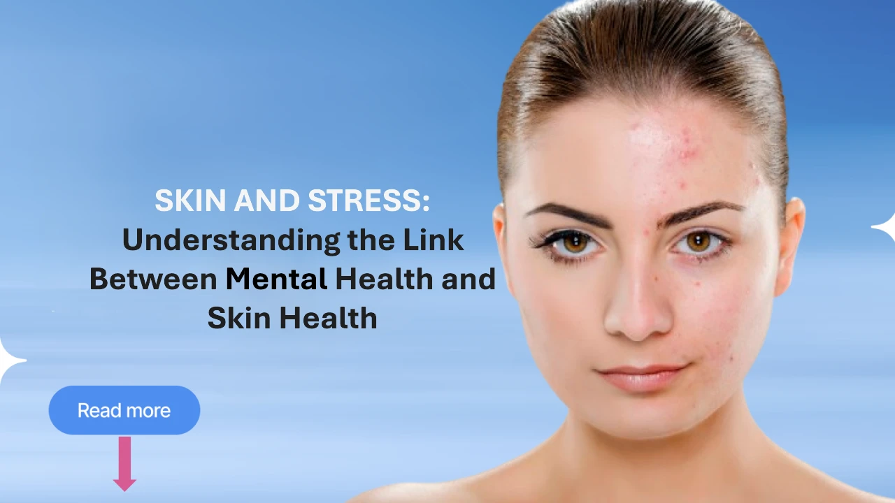 Skin and Stress: Understanding the Link Between Mental Health and Skin Health