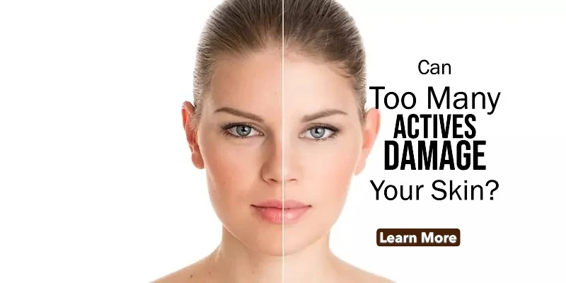 Can Too Many Actives Damage Your Skin? Signs You’re Overdoing Your Skincare Routine