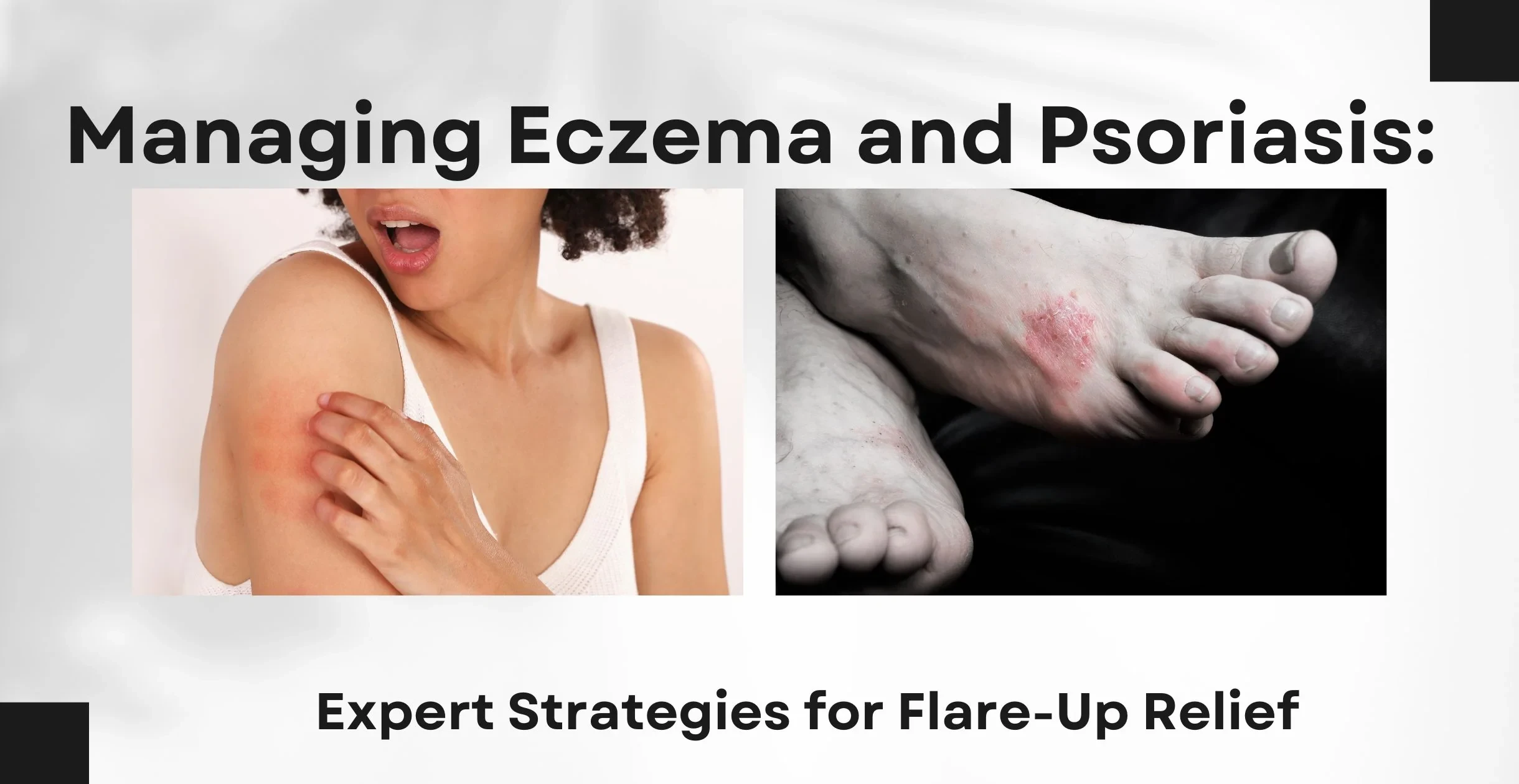 How Should You Change Your Skincare If You Have Eczema or Psoriasis? Expert Tips for Sensitive Skin Relief