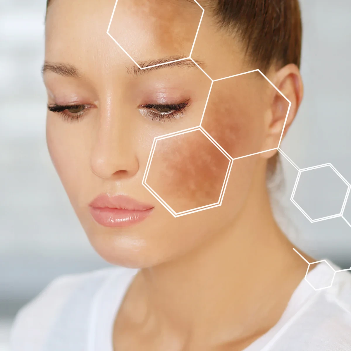 Can skincare products cause pigmentation