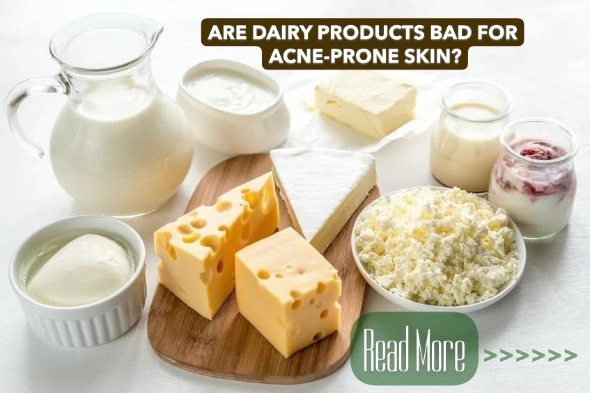 Are Dairy Products Bad for Acne-Prone Skin? Uncovering the Truth Behind the Breakout Connection