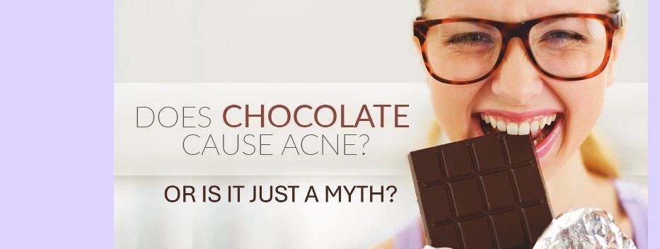 Does Chocolate Really Cause Acne or Is It Just a Myth? Uncovering the Truth About Your Favorite Treat and Breakouts