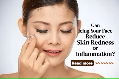 Can Icing Your Face Reduce Skin Redness or Inflammation? Exploring the Cooling Benefits for Calm, Clear Skin