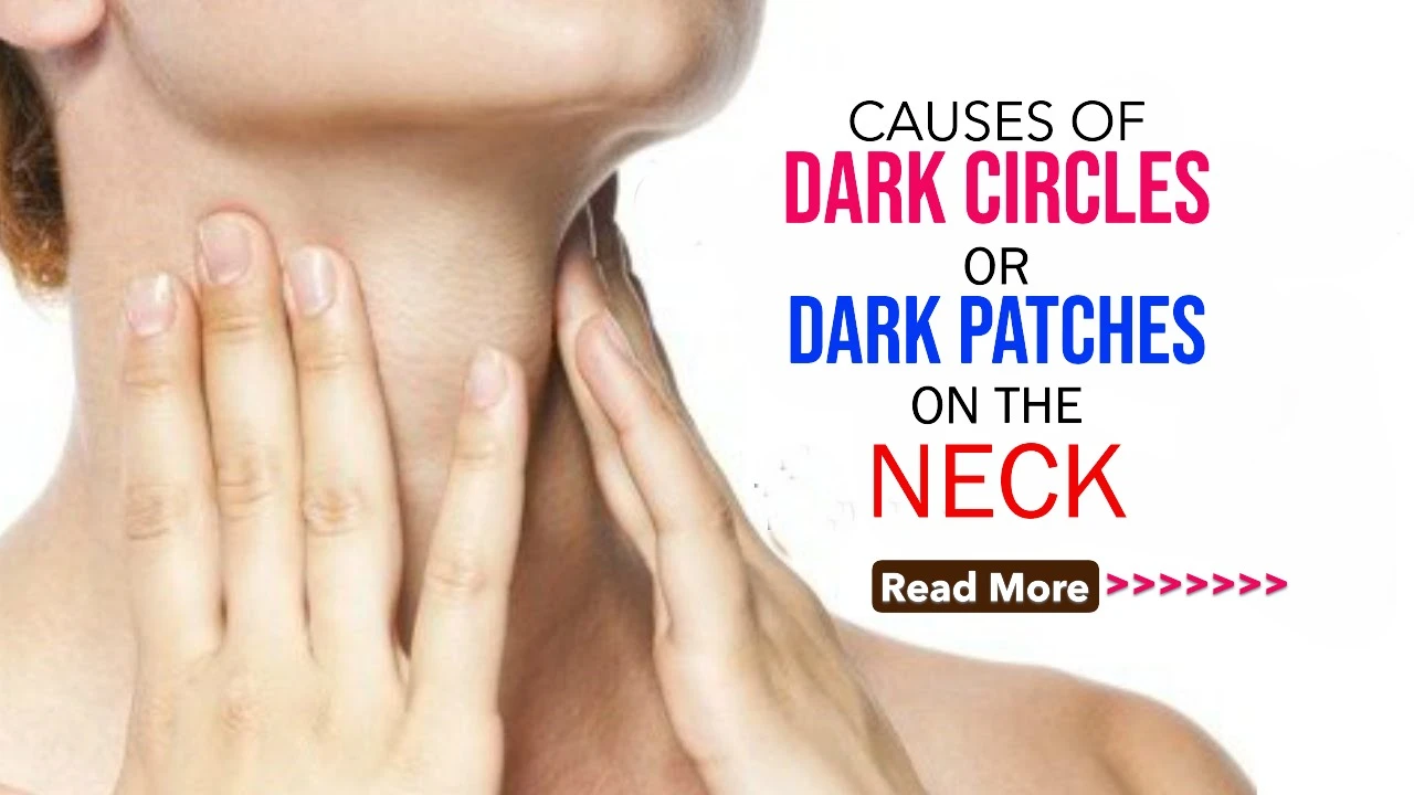 What Causes Dark Circles or Dark Patches on the Neck? Understanding Common Triggers and Solutions