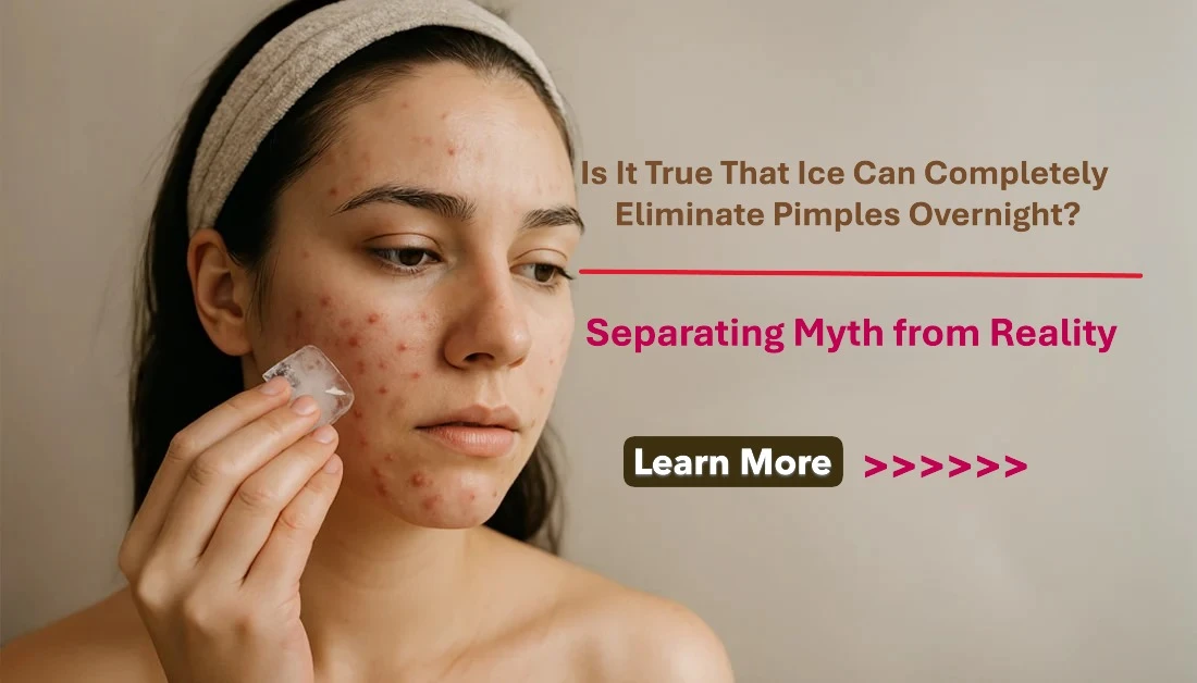 Is It True That Ice Can Completely Eliminate Pimples Overnight? Separating Myth from Reality