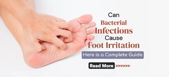 Can Bacterial Infections Cause Foot Irritation? Understanding the Causes and Prevention Tips