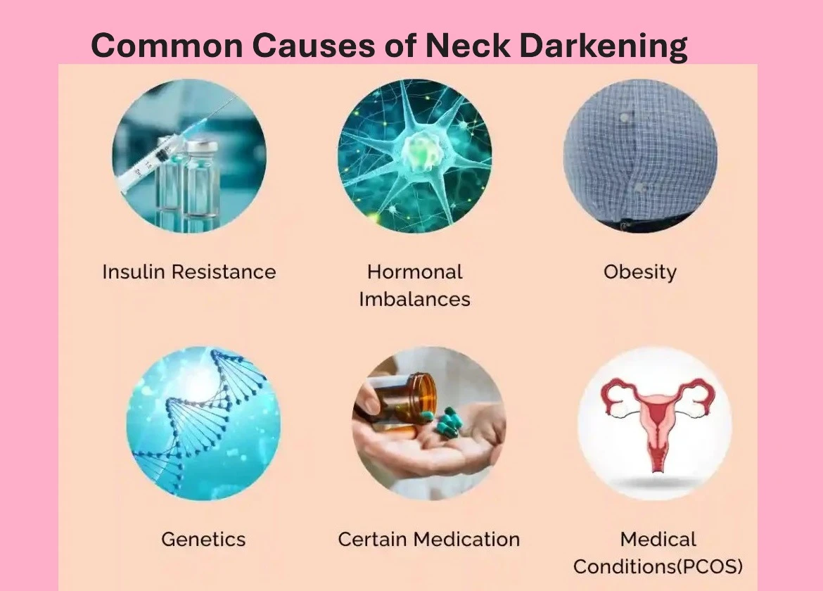 Why Do Some People Develop Dark Skin on the Back of the Neck? Exploring Causes and Prevention Tips