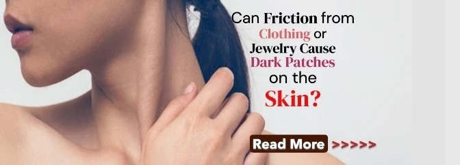 Can Friction from Clothing or Jewelry Cause Dark Patches on the Skin? Understanding the Link and Prevention Tips