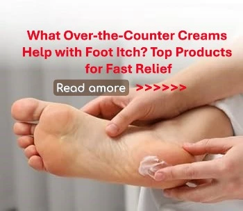 What Over-the-Counter Creams Help with Foot Itch? Top Products for Fast Relief