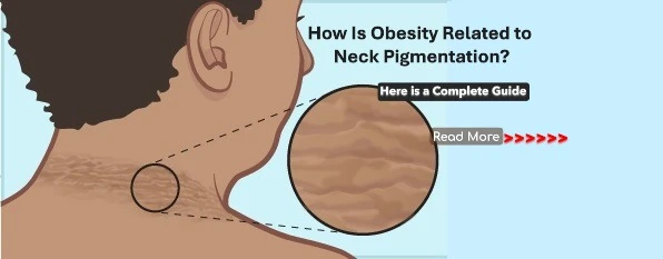 How Is Obesity Related to Neck Pigmentation? Understanding the Link Between Weight and Darkened Skin