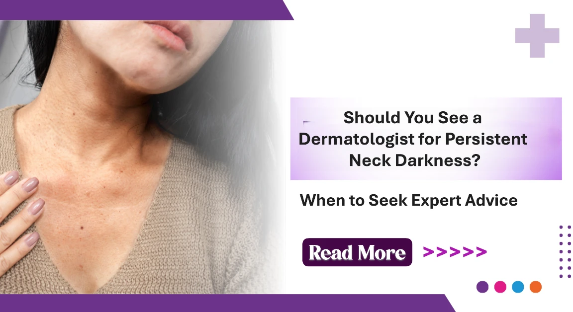 Should You See a Dermatologist for Persistent Neck Darkness? When to Seek Expert Advice