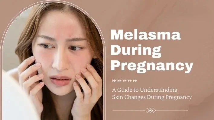 What Is Melasma (the “Mask of Pregnancy”) and Why Does It Appear? Understanding Causes and Triggers