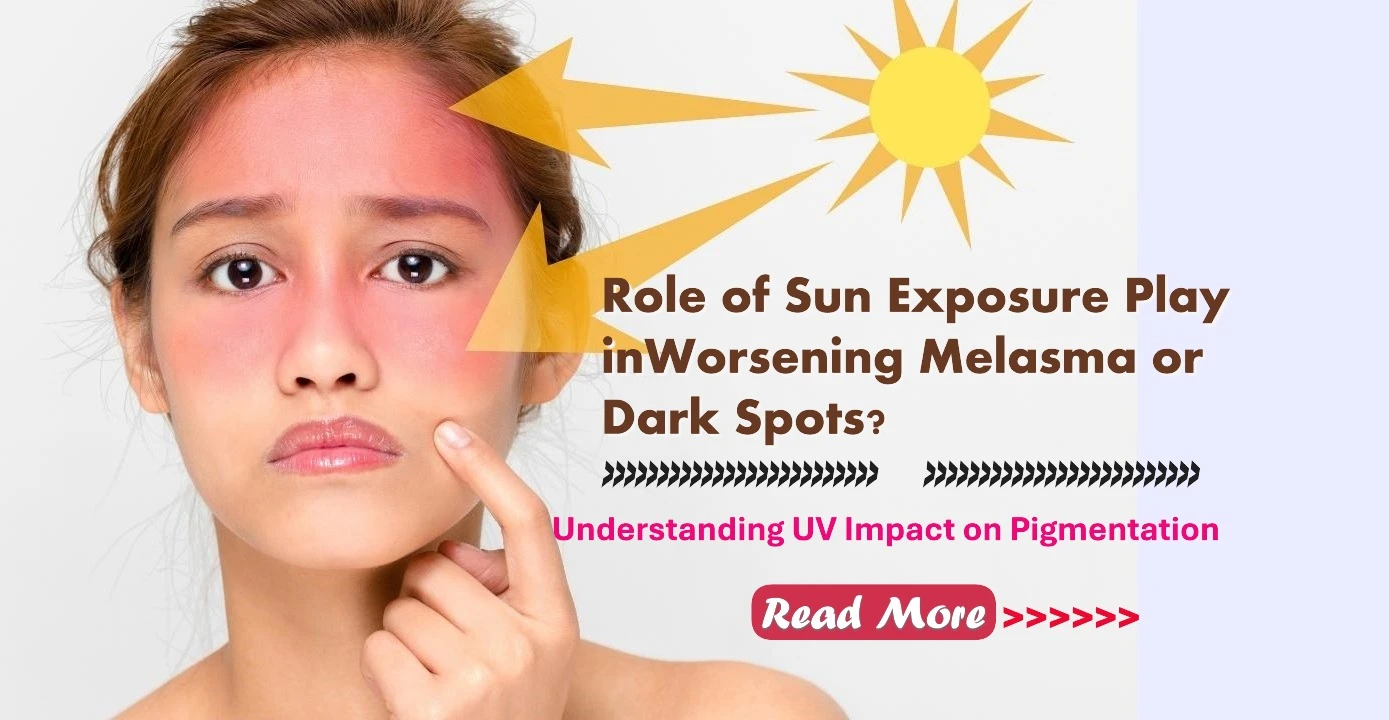 What Role Does Sun Exposure Play in Worsening Melasma or Dark Spots? Understanding UV Impact on Pigmentation