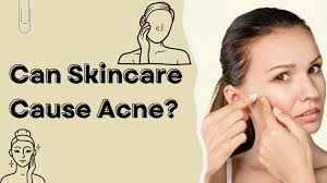 Can skincare cause acne