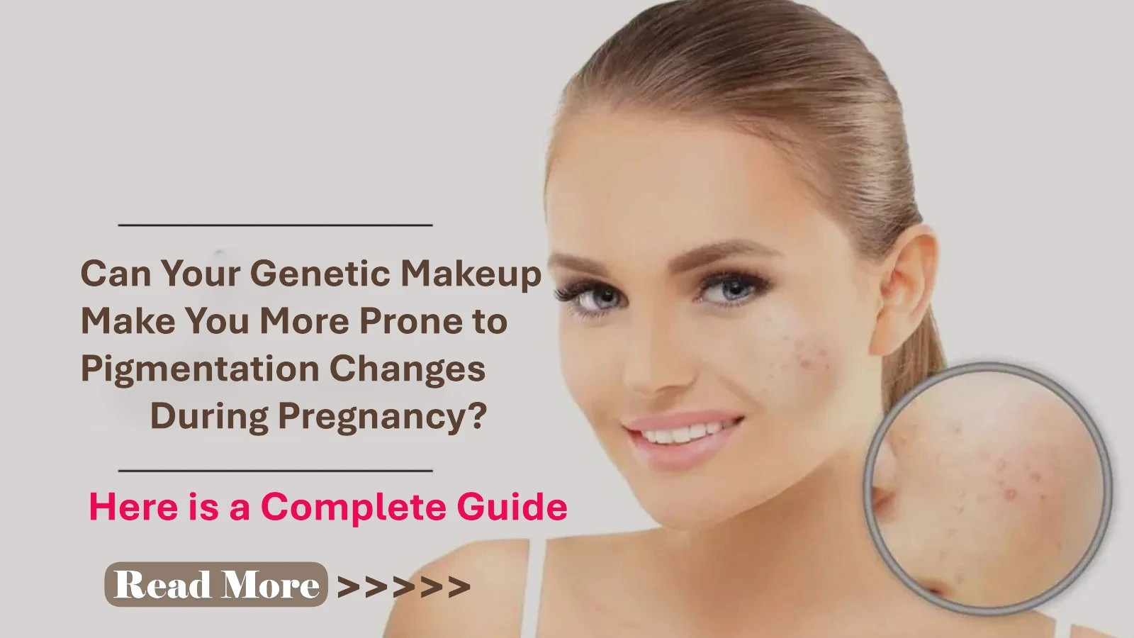 Can Your Genetic Makeup Make You More Prone to Pigmentation Changes During Pregnancy? Understanding the Hereditary Factors