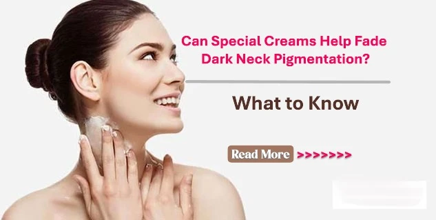 Can Special Creams Help Fade Dark Neck Pigmentation? What to Know