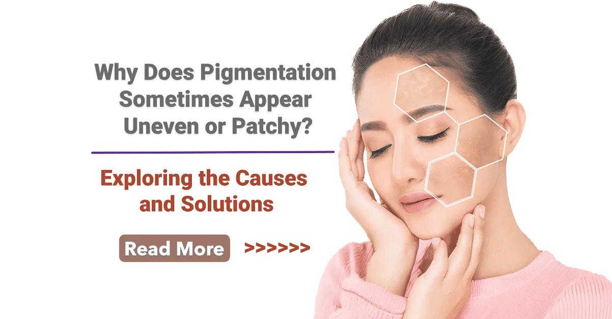 Why Does Pigmentation Sometimes Appear Uneven or Patchy? Exploring the Causes and Solutions
