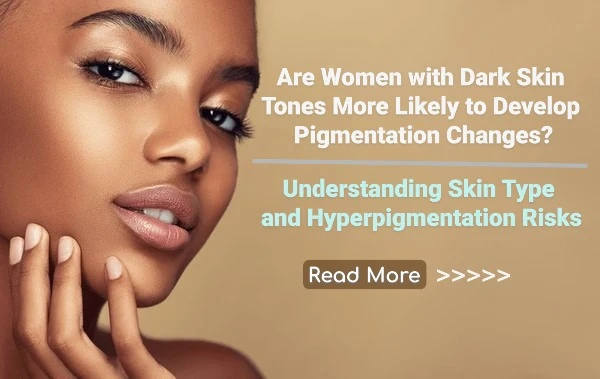 Are Women with Dark Skin Tones More Likely to Develop Pigmentation Changes? Understanding Skin Type and Hyperpigmentation Risks