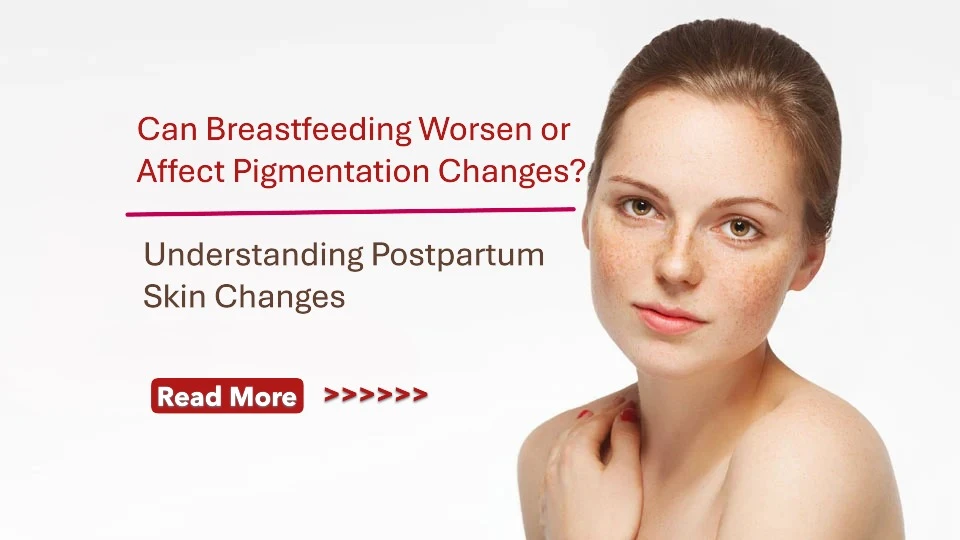 Can Breastfeeding Worsen or Affect Pigmentation Changes? Understanding Postpartum Skin Changes