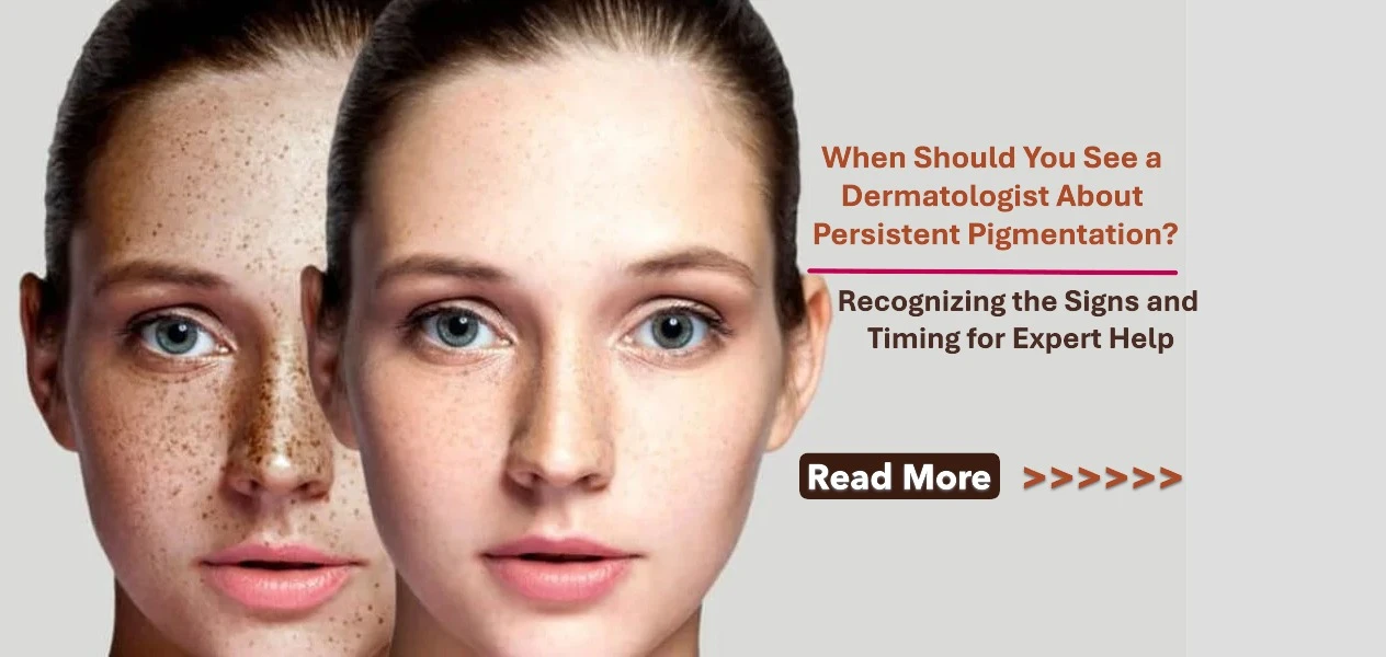 When Should You See a Dermatologist About Persistent Pigmentation? Recognizing the Signs and Timing for Expert Help