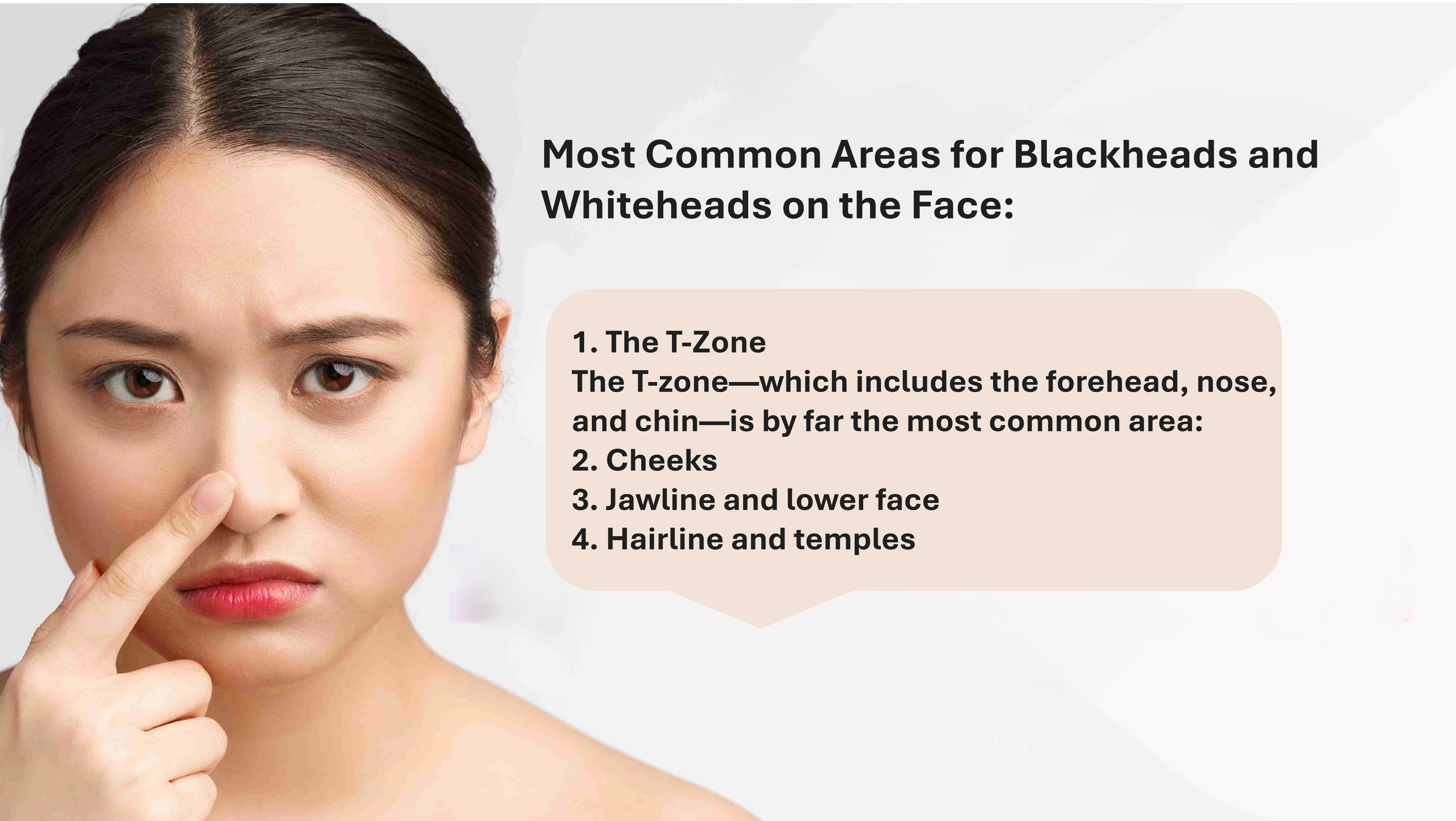 Where on the Face Are Blackheads and Whiteheads Most Common? Understanding High-Risk Zones and Why They Appear