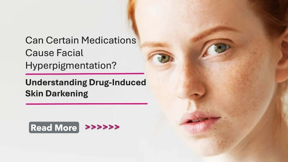 Can Certain Medications Cause Facial Hyperpigmentation? Understanding Drug-Induced Skin Darkening