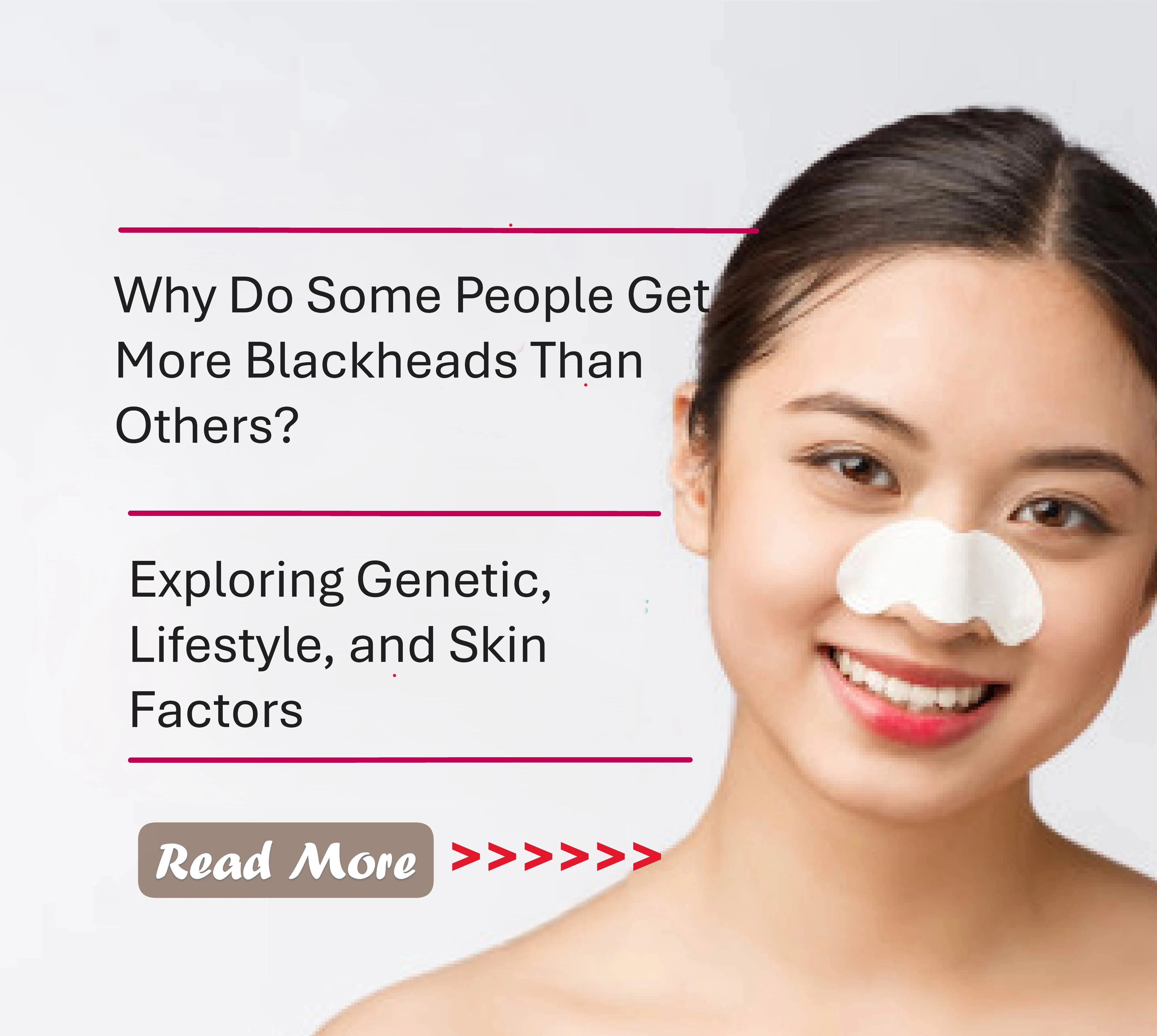 Why Do Some People Get More Blackheads Than Others? Exploring Genetic, Lifestyle, and Skin Factors