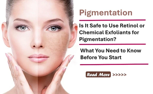 Is It Safe to Use Retinol or Chemical Exfoliants for Pigmentation? What You Need to Know Before You Start