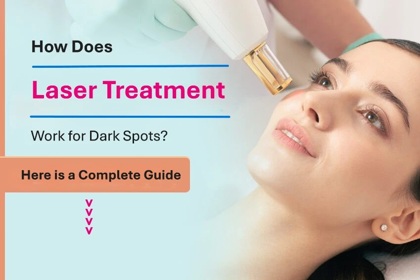 How Does Laser Treatment Work for Dark Spots? Understanding the Science Behind Clearer, Even-Toned Skin