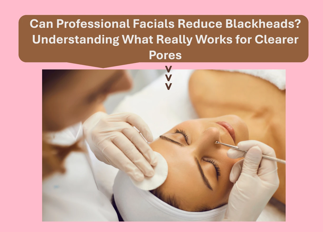 Can Professional Facials Reduce Blackheads? Understanding What Really Works for Clearer Pores