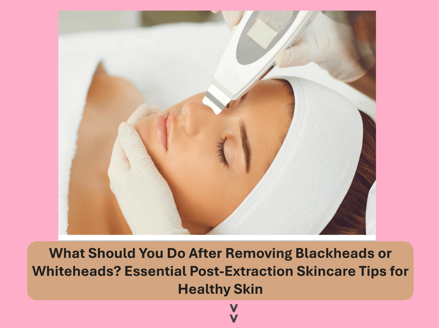 What Should You Do After Removing Blackheads or Whiteheads? Essential Post-Extraction Skincare Tips for Healthy Skin