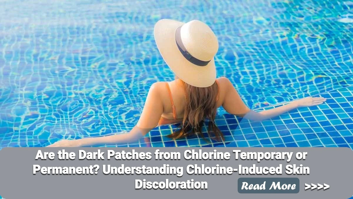 Are the Dark Patches from Chlorine Temporary or Permanent? Understanding Chlorine-Induced Skin Discoloration