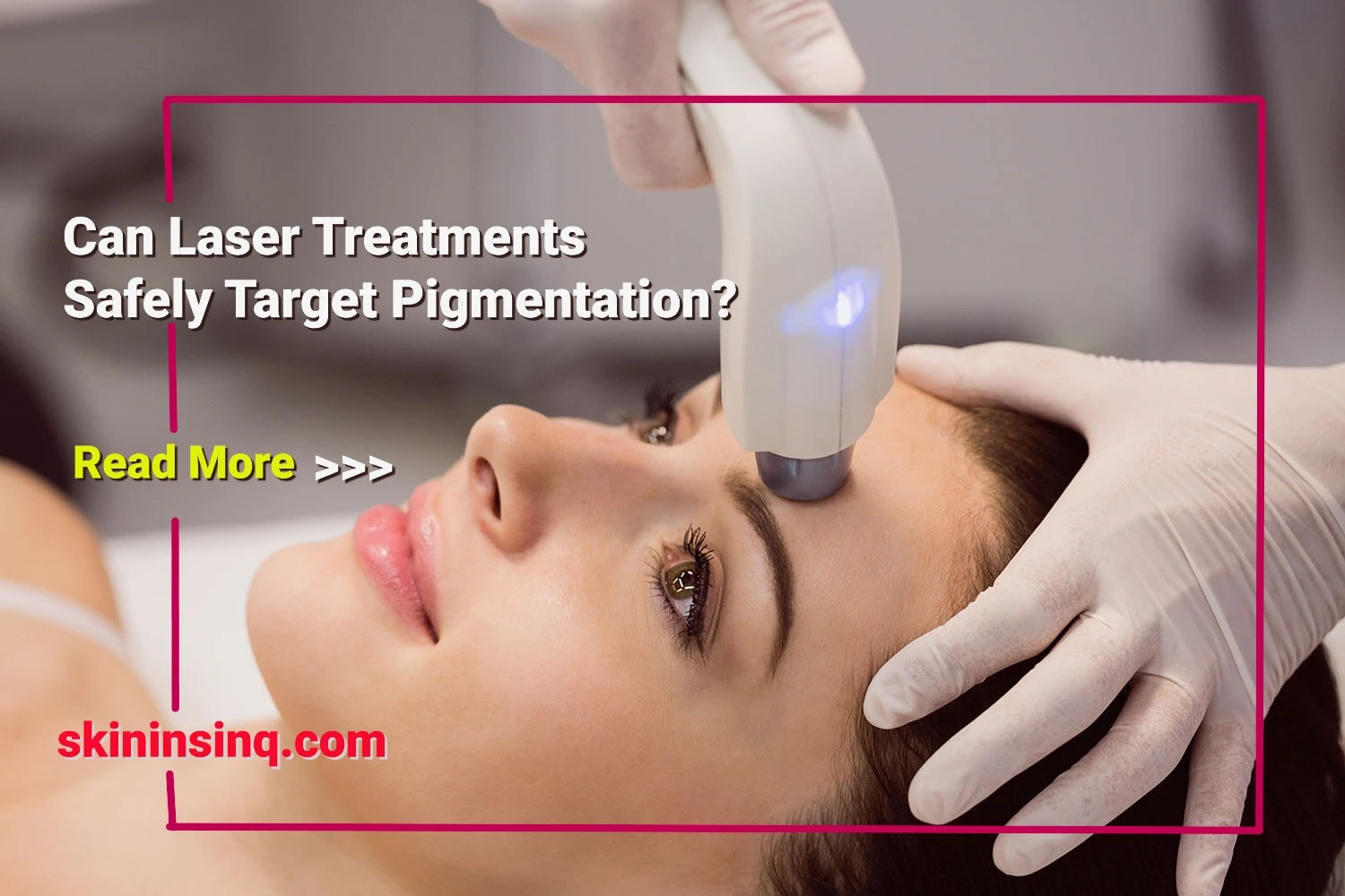 Can Laser Treatments Safely Target Pigmentation? Understanding the Effectiveness and Risks of Laser Skin Therapy