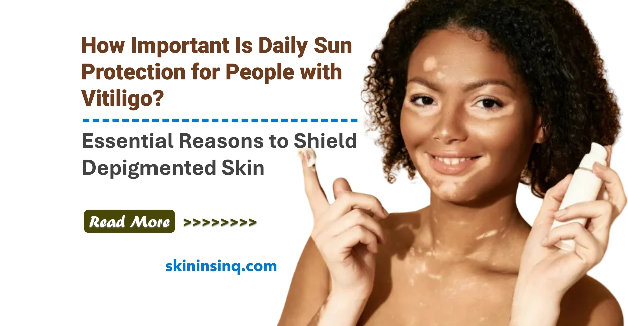 How Important Is Daily Sun Protection for People with Vitiligo? Essential Reasons to Shield Depigmented Skin