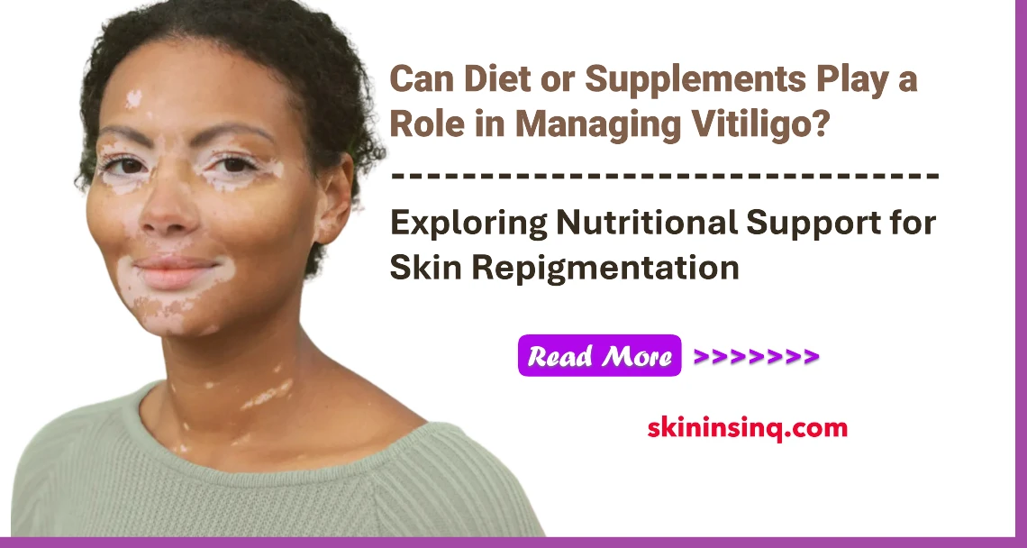Can Diet or Supplements Play a Role in Managing Vitiligo? Exploring Nutritional Support for Skin Repigmentation