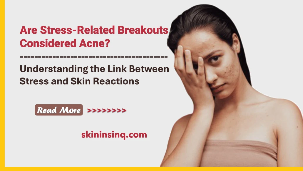 Are Stress-Related Breakouts Considered Acne? Understanding the Link Between Stress and Skin Reactions