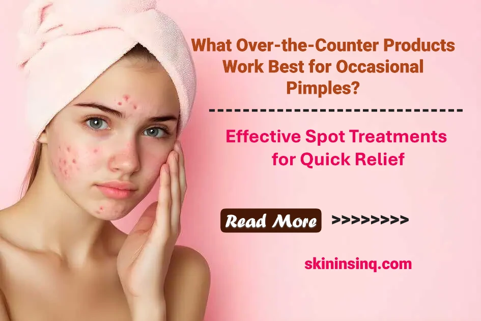 What Over-the-Counter Products Work Best for Occasional Pimples? Effective Spot Treatments for Quick Relief