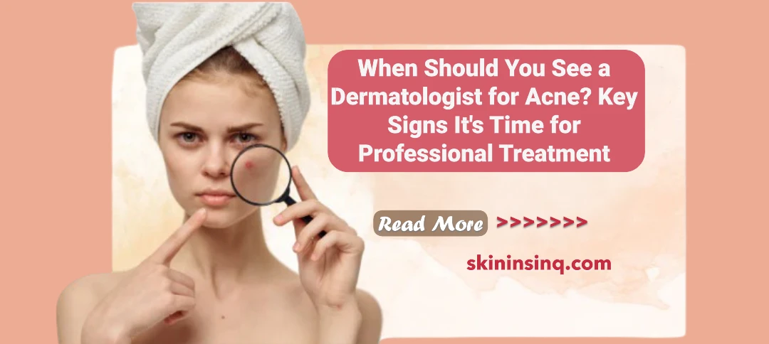 When Should You See a Dermatologist for Acne? Key Signs It's Time for Professional Treatment