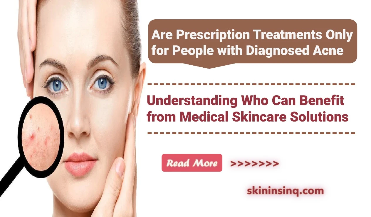 Are Prescription Treatments Only for People with Diagnosed Acne? Understanding Who Can Benefit from Medical Skincare Solutions