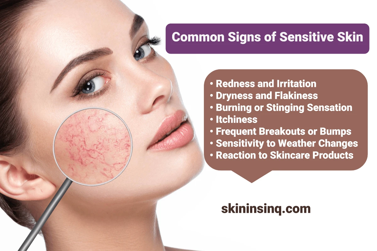 What Are the Signs That You Have Sensitive Skin? Key Symptoms to Help You Identify This Delicate Skin Type