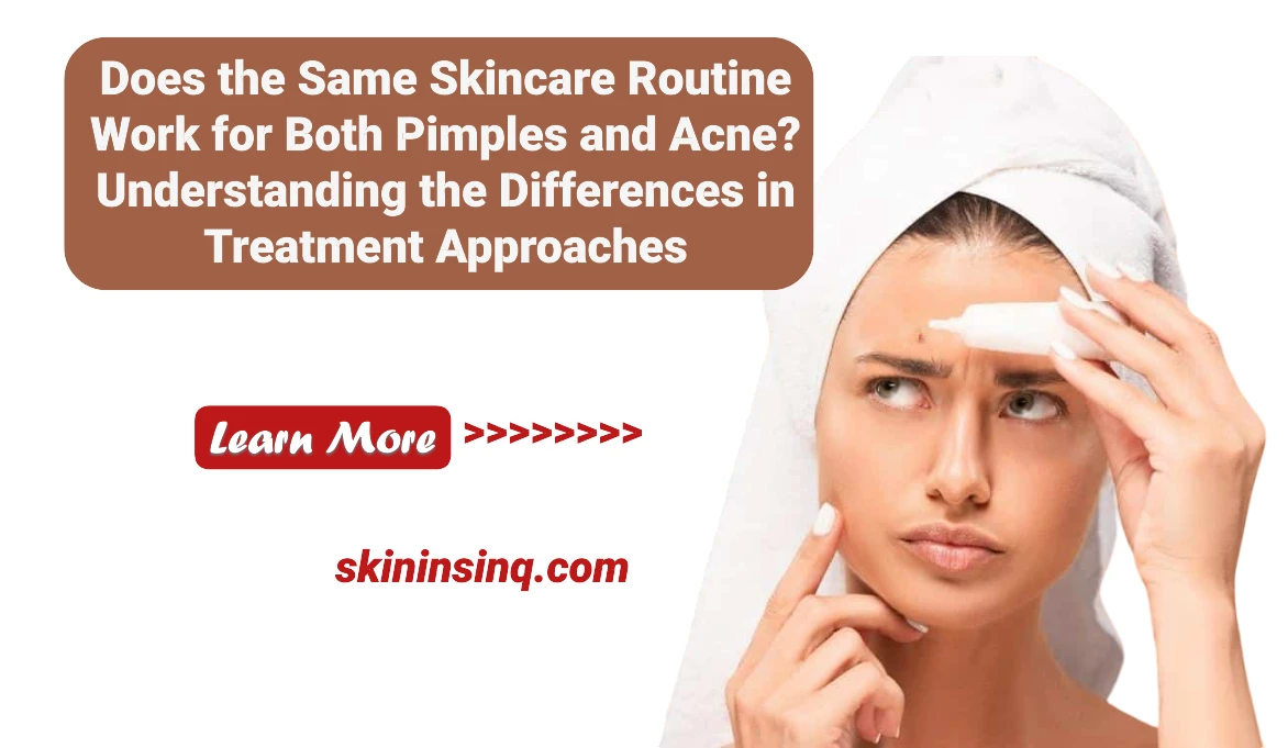 Does the Same Skincare Routine Work for Both Pimples and Acne? Understanding the Differences in Treatment Approaches