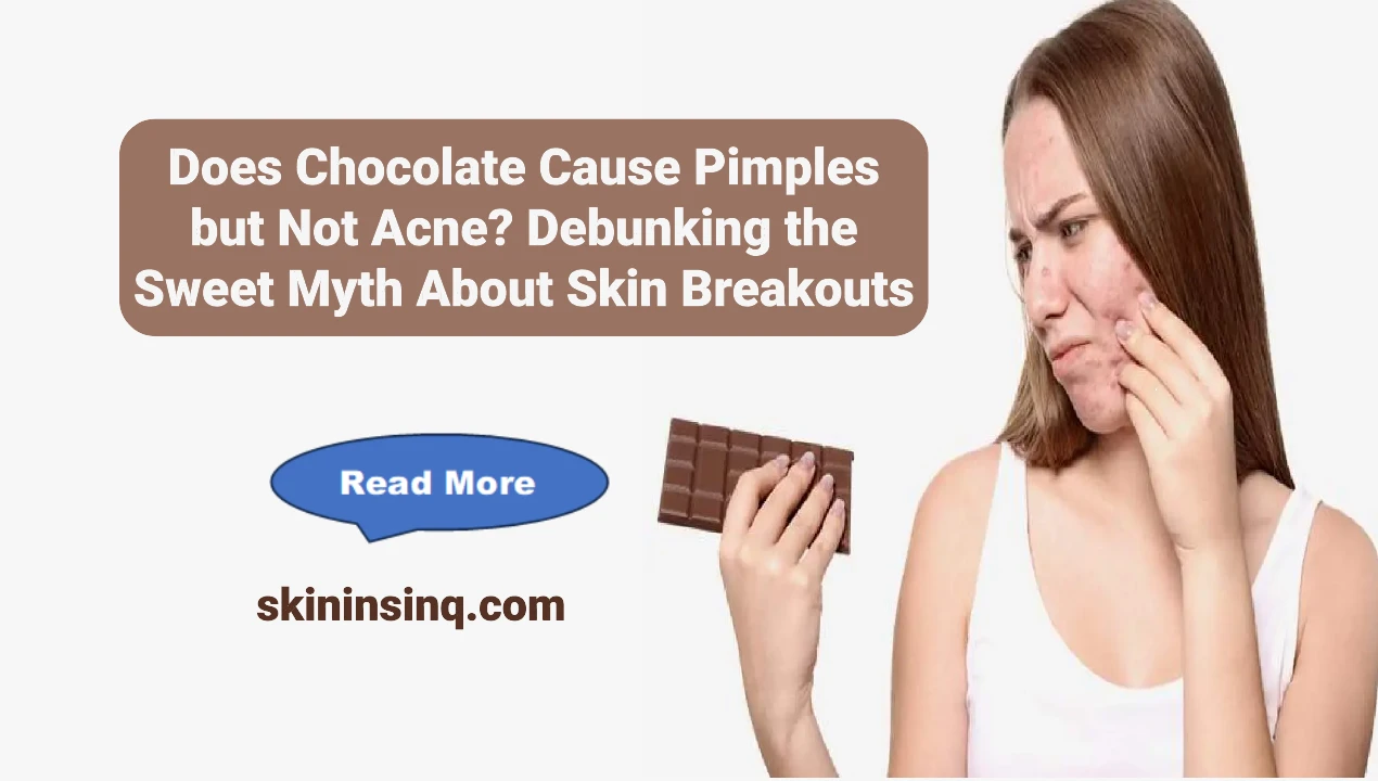 Does Chocolate Cause Pimples but Not Acne? Debunking the Sweet Myth About Skin Breakouts