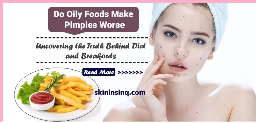 Do Oily Foods Make Pimples Worse? Uncovering the Truth Behind Diet and Breakouts