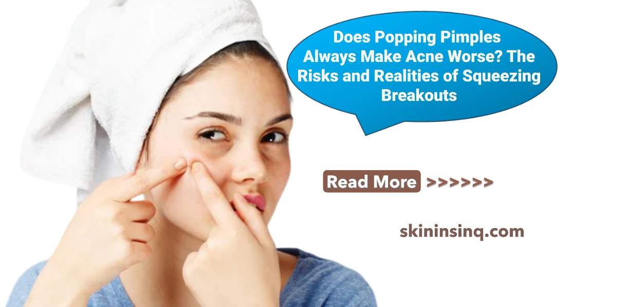 Does Popping Pimples Always Make Acne Worse? The Risks and Realities of Squeezing Breakouts