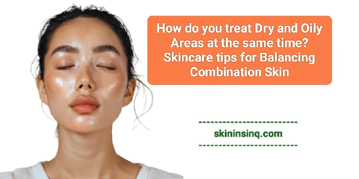 How Do You Treat Dry and Oily Areas at the Same Time? Skincare Tips for Balancing Combination Skin