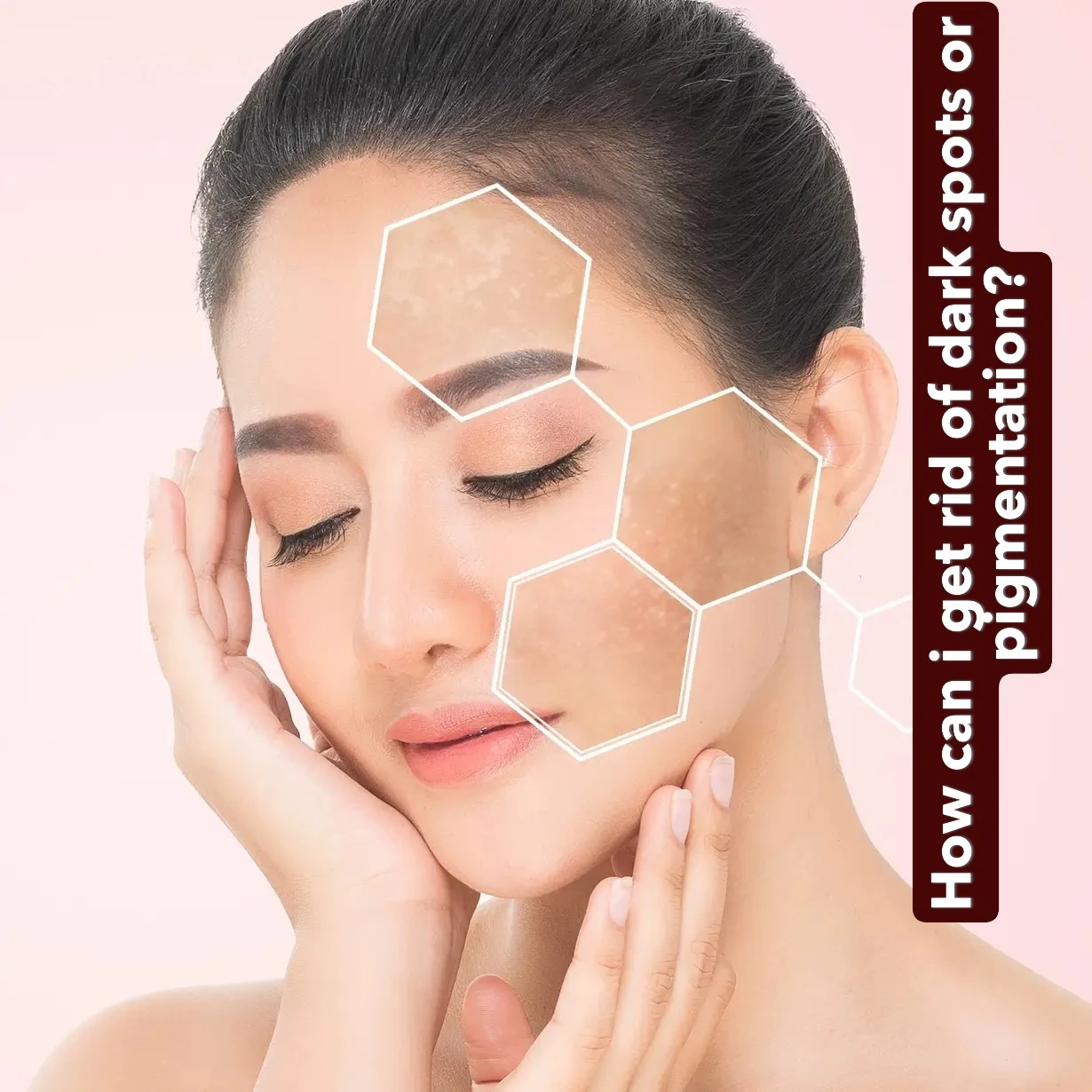 How can i get rid of dark spots or pigmentation?