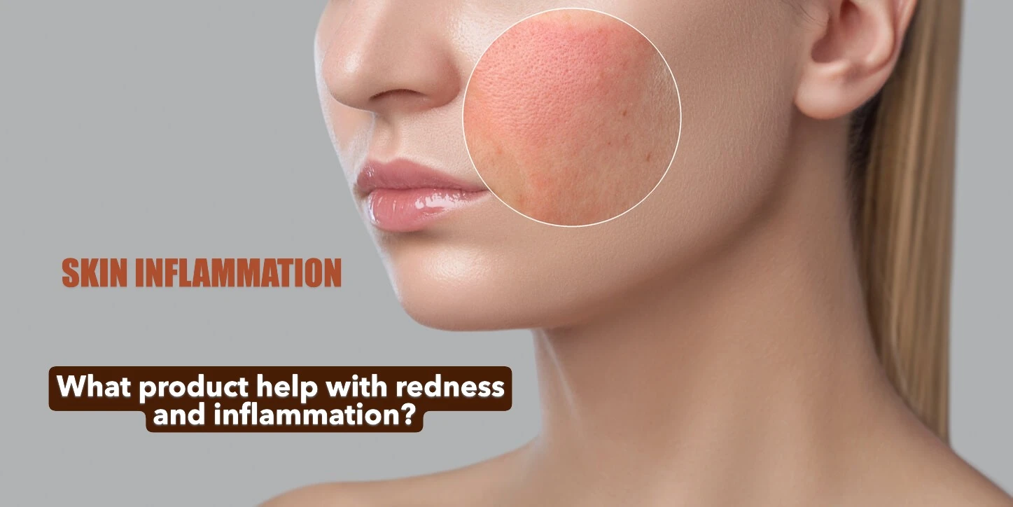 What product help with redness and inflammation?