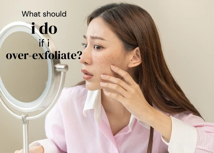 What should i do if i over-exfoliate?